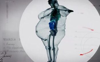 En man som väger 444 kg i magnetröntgen – chockerande syn! + video!